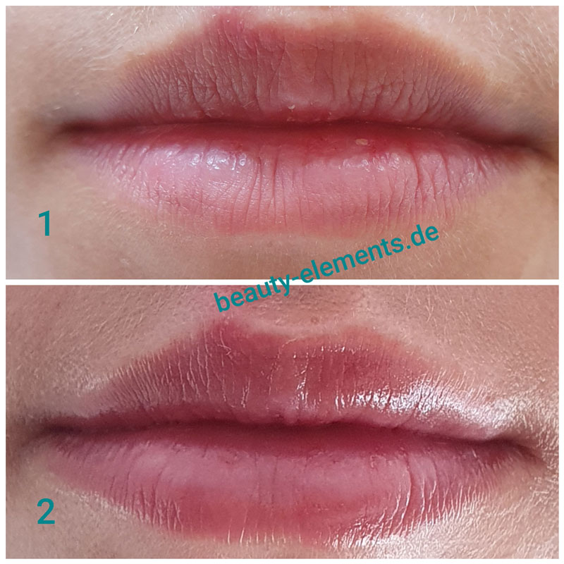 Beauty Elements - Perfekt - Lips Vor & Nach