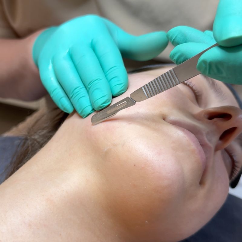 Dermaplaning & Oilplaning
